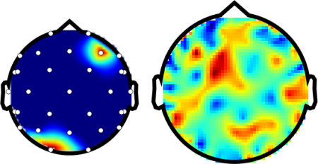 Topography plot of MEG data